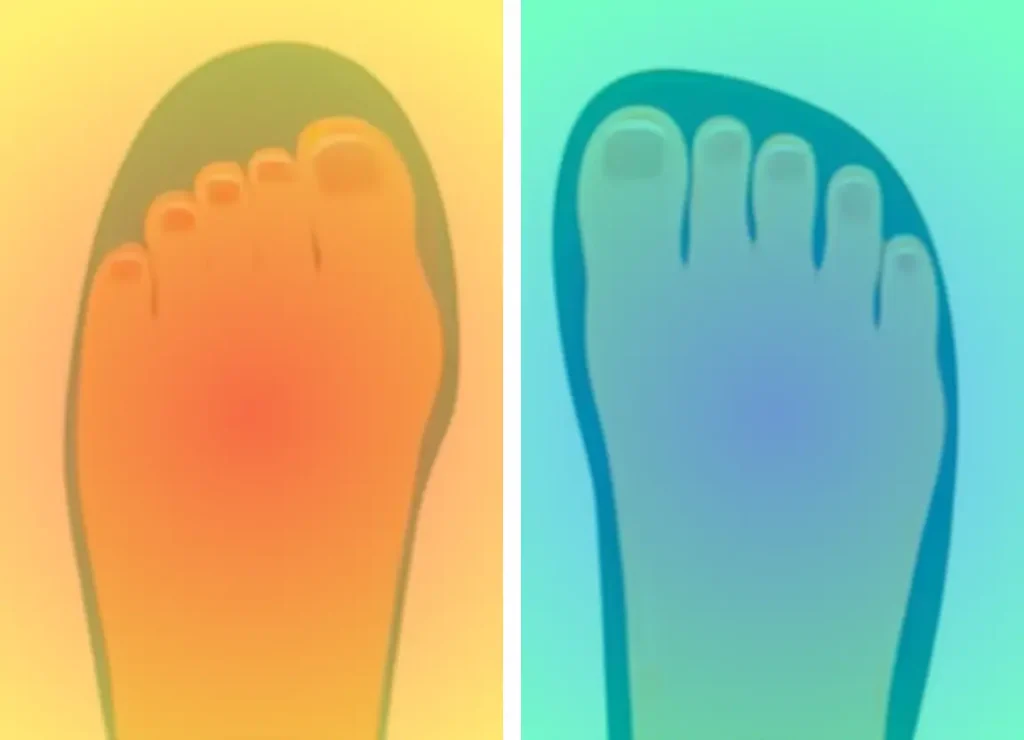 Heat map visualization showing foot pressure distribution in narrow toe box vs wide toe box shoes, with red indicating high pressure areas